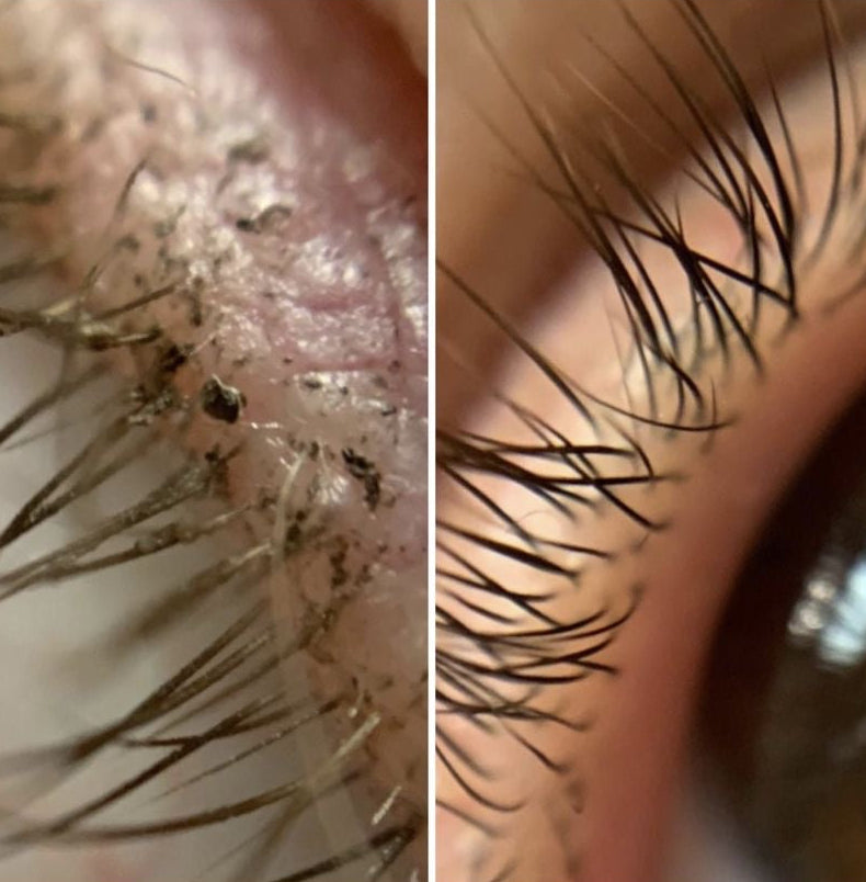 Lash cleanser set